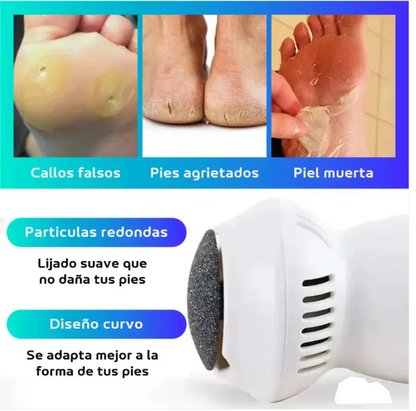 Pack Salud & Renovación – ¡Despídete de los callos y toxinas!